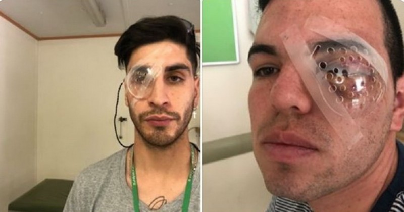 Miembros de la policía nacional de Chile (Carabineros) cometieron graves violaciones de derechos humanos dice HRW