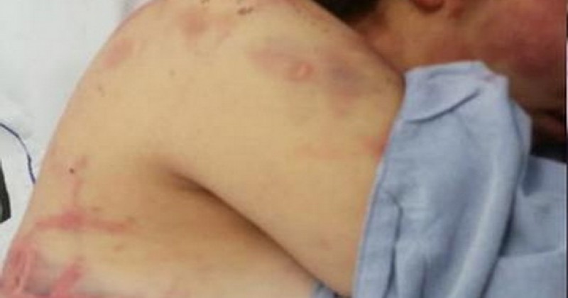 Podría quedar libre karateca que propinó golpiza a su novia en Mérida el año pasado por justicia federal