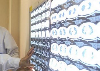 Falleció una persona por influenza en Yucatán