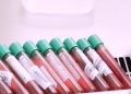 El equipo de investigadores de la Universidad de Oxford que trabajan para desarrollar una vacuna contra el Sars Cov 2 declararon al diario médico The Lancet que no hay problemas de seguridad y la vacuna estimuló una fuerte respuesta inmune