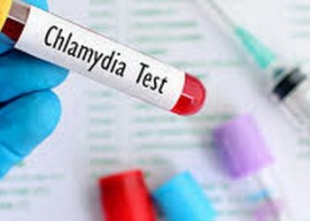 En lo que va del año, Colima y Yucatán son las únicas entidades del país libres de clamidia, Enfermedad de Transmisión Sexual / Es notable el aumento, principalmente en Quintana Roo