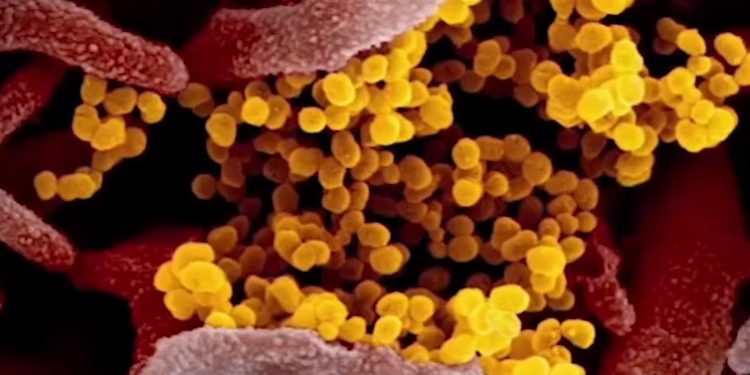 El coronavirus mutó, tornándose más contagioso, dicen investigadores del Hospital Metodista de Houston, Texas