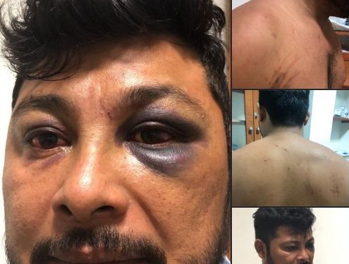 Carlos Cuau Sulu denunció detención ilegal, torturas y golpes propinados por policías municipales de Chicxulub Pueblo el pasado 11 de noviembre