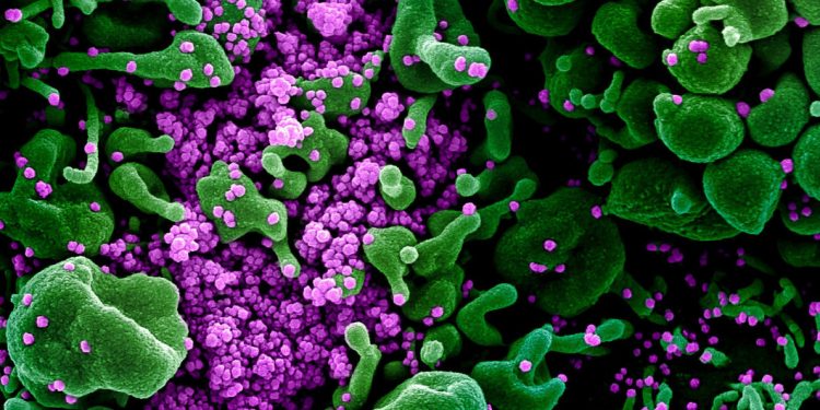 Mayor transmisibilidad podría generar un aumento en los casos y las hospitalizaciones : Japón ha notificado una nueva variante del coronavirus que causa el COVID-19