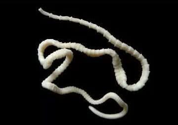 En Yucatán se registra en brote de teniasis, al registrar 25 casos confirmados de esta patología derivada por el consumo de carne de cerdo contaminada